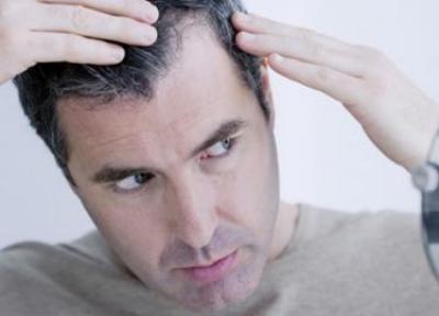 علت ریزش مو چیست؟